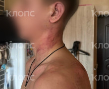 «Мама, это папа. Он был пьяный»: 14-летнего сына калининградки избил и душил бывший муж