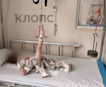Трехлетняя девочка получила перелом бедра в частном детском саду Калининграда