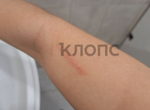 В Калининграде пожилая пассажирка напала на девушку в автобусе из-за места