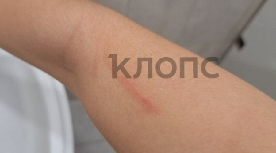 В Калининграде пожилая пассажирка напала на девушку в автобусе из-за места