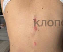 «Пока бьётся моё сердце, я не успокоюсь»: бывший муж превратил жизнь 30-летней калининградки в ад