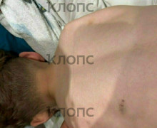Жительница Калининграда сообщила о нарушениях после перевода сына с аутизмом в другой детский сад