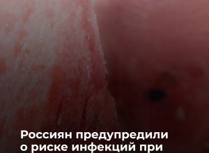 Роспотребнадзор предупредил об опасности покупки разрезанных арбузов
