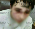Подросток из пригородного посёлка Калининграда получил травмы в школьной драке