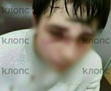 Подросток из пригородного посёлка Калининграда получил травмы в школьной драке
