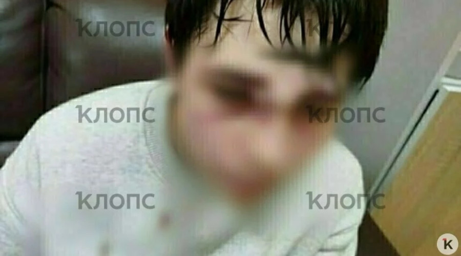 Подросток из пригородного посёлка Калининграда получил травмы в школьной драке