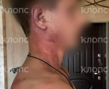 «Мама, это папа. Он был пьяный»: 14-летнего сына калининградки избил и душил бывший муж