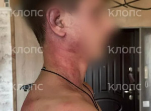 «Мама, это папа. Он был пьяный»: 14-летнего сына калининградки избил и душил бывший муж