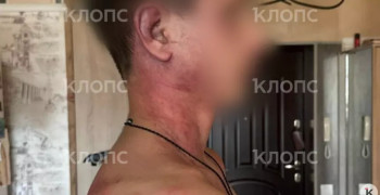 «Мама, это папа. Он был пьяный»: 14-летнего сына калининградки избил и душил бывший муж