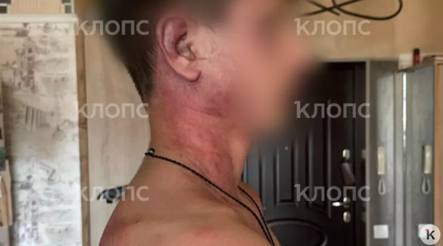 «Мама, это папа. Он был пьяный»: 14-летнего сына калининградки избил и душил бывший муж