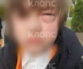 Четвероклассник из Калининграда перенес операцию после драки в школе