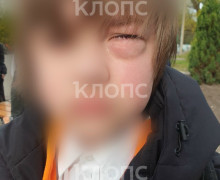 Четвероклассник из Калининграда перенес операцию после драки в школе