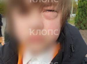 Четвероклассник из Калининграда перенес операцию после драки в школе
