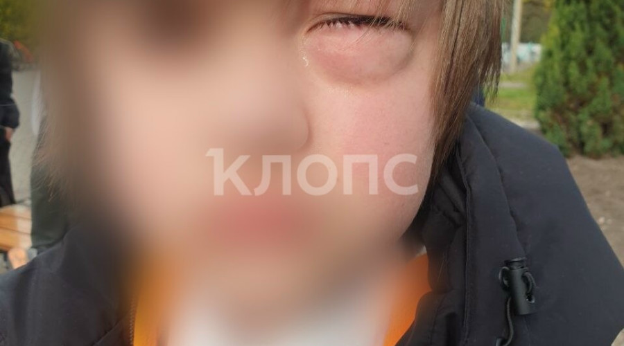 Четвероклассник из Калининграда перенес операцию после драки в школе