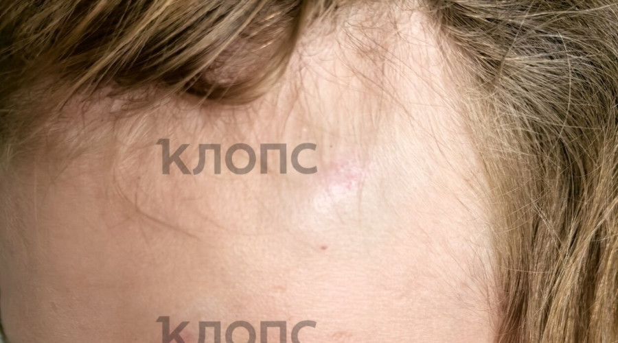Подросток госпитализирован после конфликта со взрослым в ТЦ на 9 Апреля