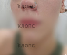 В Калининграде пожилая пассажирка напала на девушку в автобусе из-за места