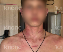 «Мама, это папа. Он был пьяный»: 14-летнего сына калининградки избил и душил бывший муж