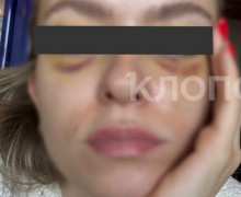 «Пока бьётся моё сердце, я не успокоюсь»: бывший муж превратил жизнь 30-летней калининградки в ад