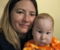 Сбор на операцию для пятимесячного калининградца закрыт благодаря читателям «Клопс»