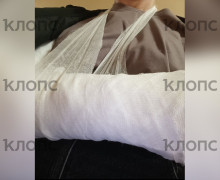 Калининградка ищет мужчину, который помог ей после тяжёлого перелома руки