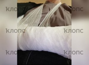 Калининградка ищет мужчину, который помог ей после тяжёлого перелома руки