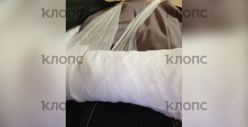 Калининградка ищет мужчину, который помог ей после тяжёлого перелома руки
