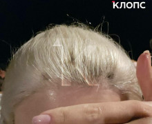 В Зеленоградске во время салюта искры попали в толпу: у женщины прожгло куртку и опалило волосы