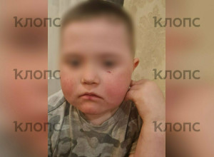 Житель Гурьевского района оштрафован за нападение на ребенка-инвалида