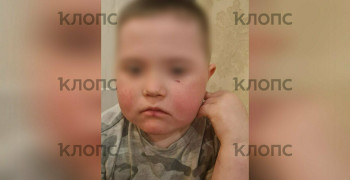 Житель Гурьевского района оштрафован за нападение на ребенка-инвалида