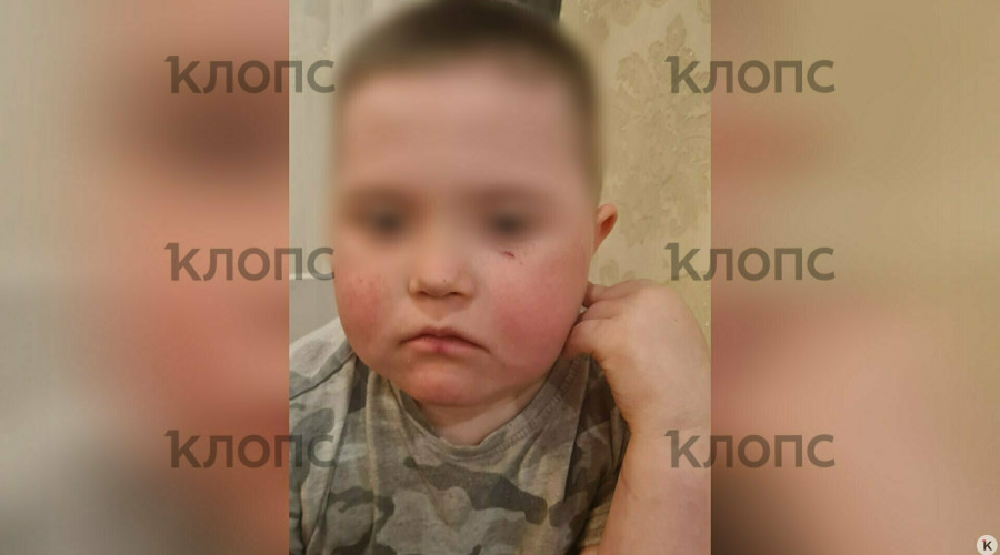 Житель Гурьевского района оштрафован за нападение на ребенка-инвалида