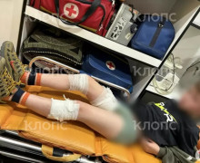Стаффордширский терьер напал на двух девятилетних мальчиков во дворе дома в Чкаловске
