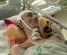 Подросток из Калининградской области после менингита ждёт операции по имплантации черепа